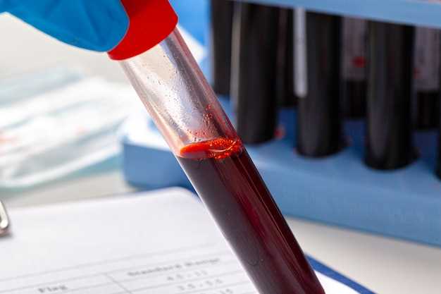 Обозначение железа в анализе крови биохимия
