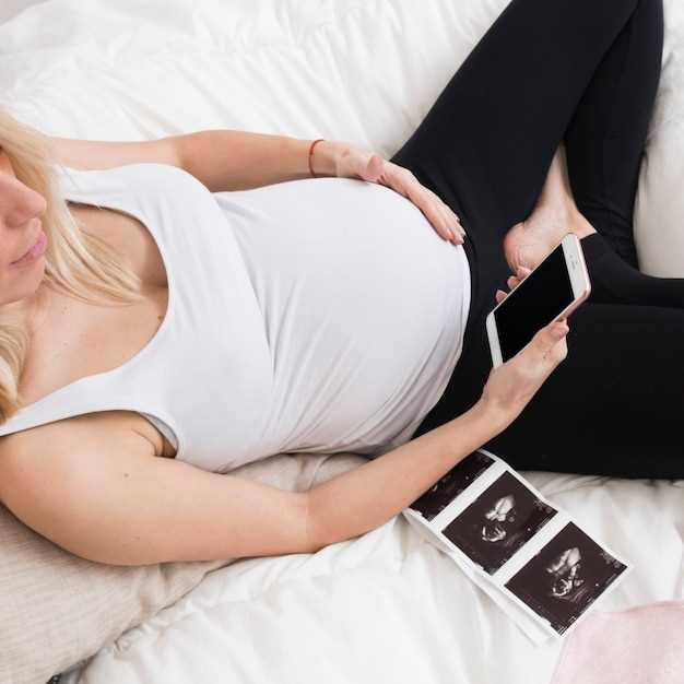 Как понять, что отходит пробка при беременности 37 недель?