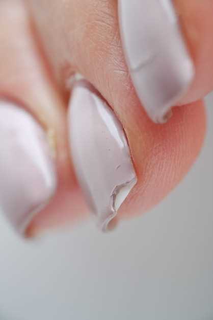Как происходит развитие нарыва на пальце возле ногтя?