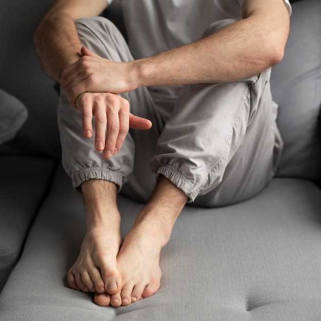 Методы лечения потницы на ногах