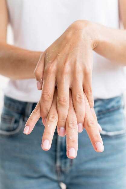 Заболевание ногтей на руках: основные симптомы и проявления